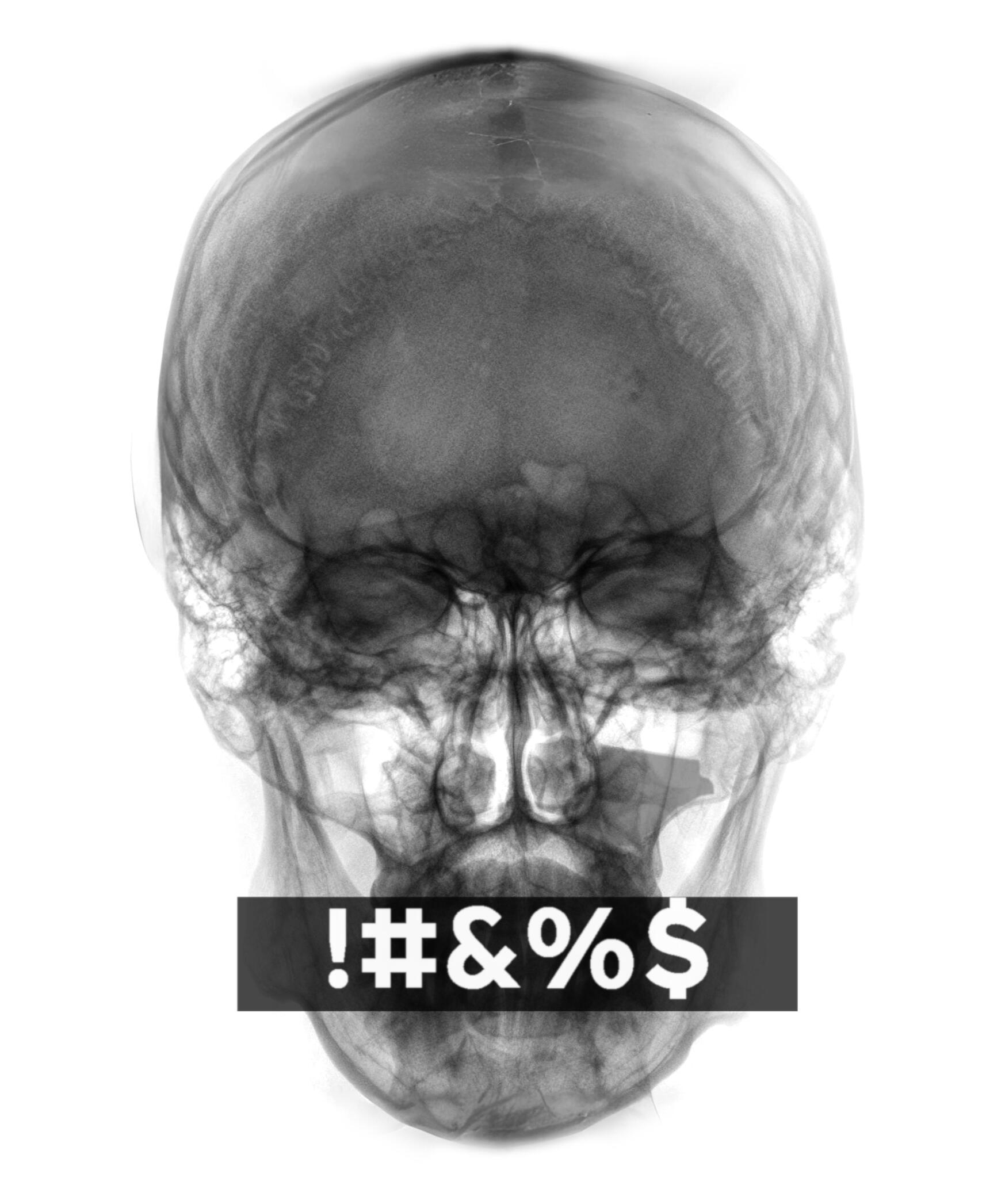 CURSING live at 715 Club